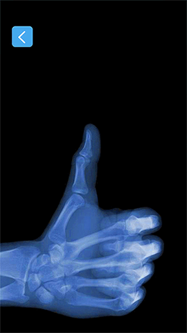 X射线模拟器[图1]